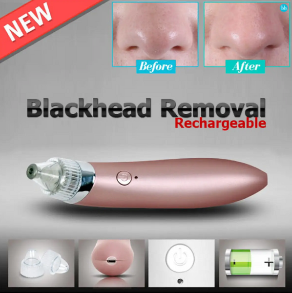 Вакуумний очисник пор обличчя Menqshahayd XN-8030 Beautiful skin care expert 03112 фото