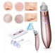 Вакуумний очисник пор обличчя Menqshahayd XN-8030 Beautiful skin care expert 03112 фото 1